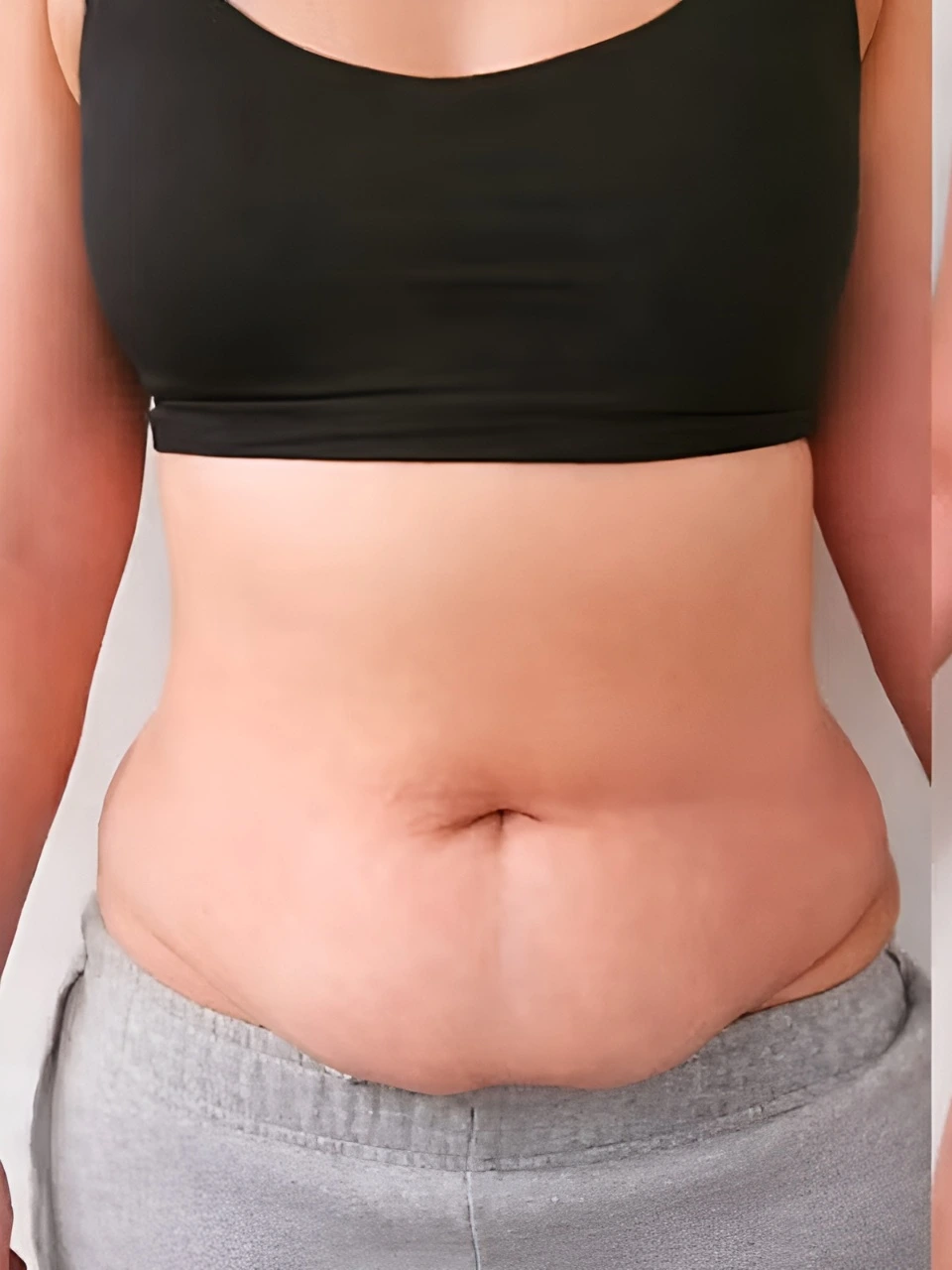 Before treatment